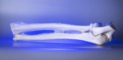 Unterarmmodell aus dem 3D-Druck