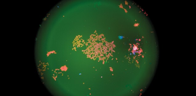 Wie ein Feuerwerk: Blick durchs Mikroskop auf RGB-markierte Krebszellen