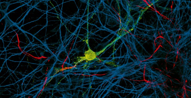 Um das Krankheitsgeschehen bei MS zu verstehen, erforschen die Mediziner die Nervenzellen