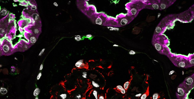 eingefärbter Schnitt durch Nierengewebe, auf schwarzem Hintergrund weiße Zellen sowie lilafarbene und rote Elemente