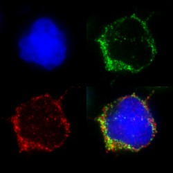 Gefärbte T-Zelle unterm Mikroskop: Zellkern (blau), Rezeptor (rot), Signalverstärker (grün). Unten rechts alle Kanäle zusammen