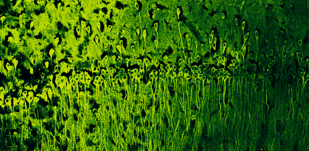 Die immunhistochemische Färbung von Nervenzellen in kortikalen Bereichen zeigt die Verteilung des Proteins Tubulinalpha4a in einem Hirnbereich, der bei der Alzheimerschen Krankheit stark betroffen ist