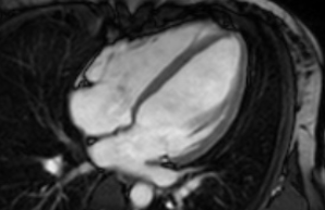 Röntgenbild des Oberkörpers